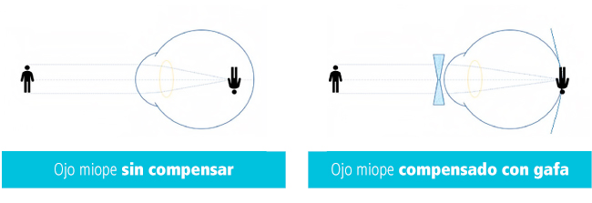 lentillas-diarias-misight